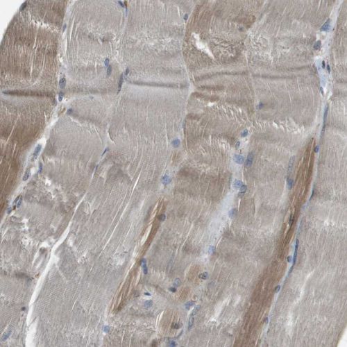 Immunohistochemistry (Formalin/PFA-fixed paraffin-embedded sections) - Anti-SEC62 antibody (AB244335)