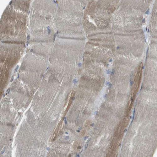 Immunohistochemistry (Formalin/PFA-fixed paraffin-embedded sections) - Anti-SEC62 antibody (AB244335)