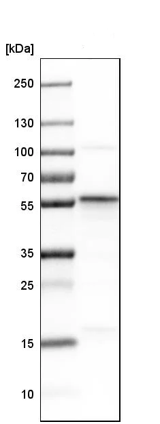 Western blot - Anti-SEC62 antibody (AB244335)