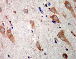 Immunohistochemistry (Formalin/PFA-fixed paraffin-embedded sections) - Anti-SEC62 antibody [EPR9212] - BSA and Azide free (AB248771)