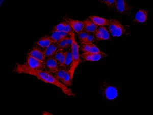 Immunocytochemistry/ Immunofluorescence - Anti-SEC62 antibody [EPR9213] (AB140644)