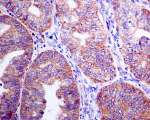 Immunohistochemistry (Formalin/PFA-fixed paraffin-embedded sections) - Anti-SEC62 antibody [EPR9213] (AB140644)