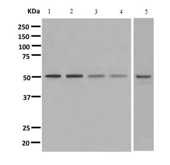 Western blot - Anti-SEC62 antibody [EPR9213] (AB140644)