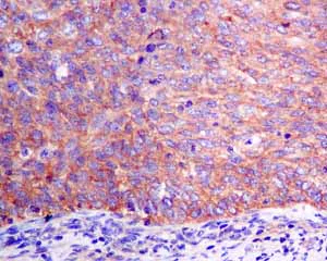 Immunohistochemistry (Formalin/PFA-fixed paraffin-embedded sections) - Anti-SEC62 antibody [EPR9213] - BSA and Azide free (AB248926)