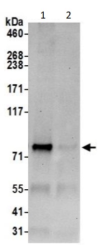 Immunoprecipitation - Anti-SEC63 antibody (AB240567)