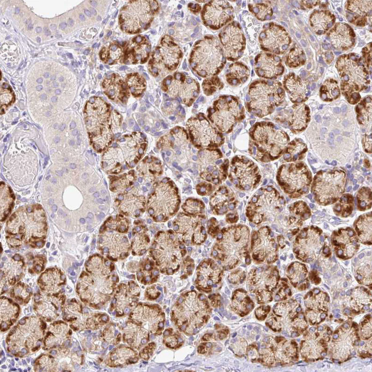 Immunohistochemistry (Formalin/PFA-fixed paraffin-embedded sections) - Anti-SEC63 antibody (AB244497)