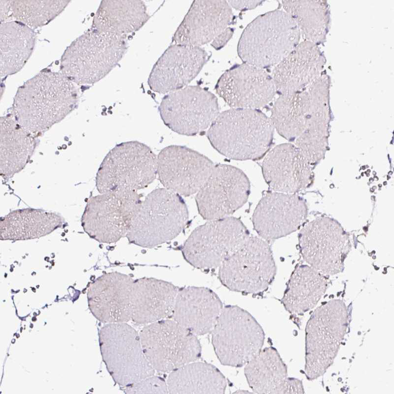 Immunohistochemistry (Formalin/PFA-fixed paraffin-embedded sections) - Anti-SEC63 antibody (AB244497)