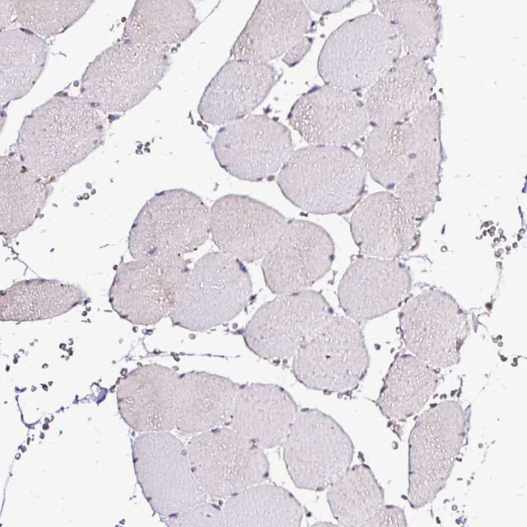 Immunohistochemistry (Formalin/PFA-fixed paraffin-embedded sections) - Anti-SEC63 antibody (AB244497)