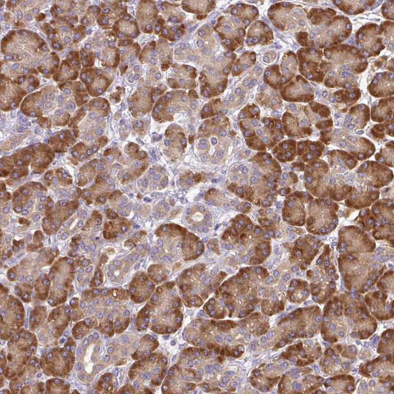 Immunohistochemistry (Formalin/PFA-fixed paraffin-embedded sections) - Anti-SEC63 antibody (AB244497)