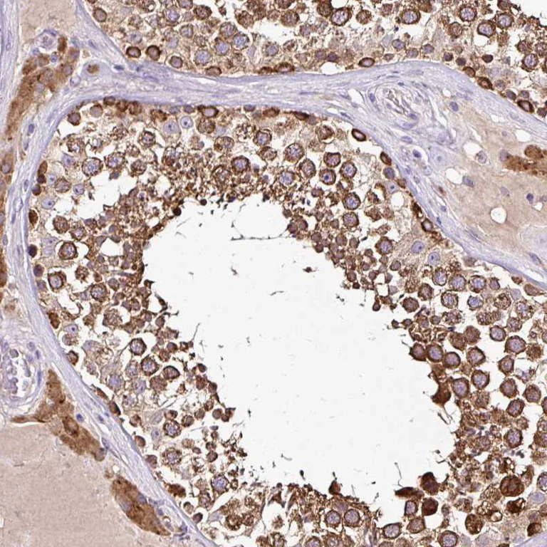 Immunohistochemistry (Formalin/PFA-fixed paraffin-embedded sections) - Anti-SEC63 antibody (AB244497)
