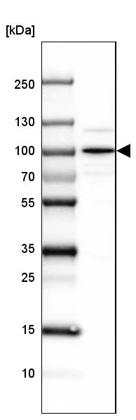 Western blot - Anti-SEC63 antibody (AB244497)