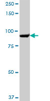 Western blot - Anti-SEC63 antibody (AB68550), expandable thumbnail