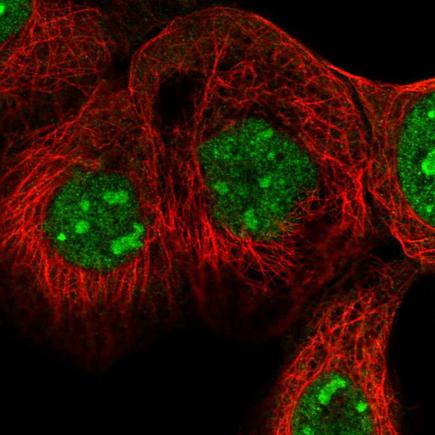 Immunocytochemistry/ Immunofluorescence - Anti-Sec8 antibody (AB220900)