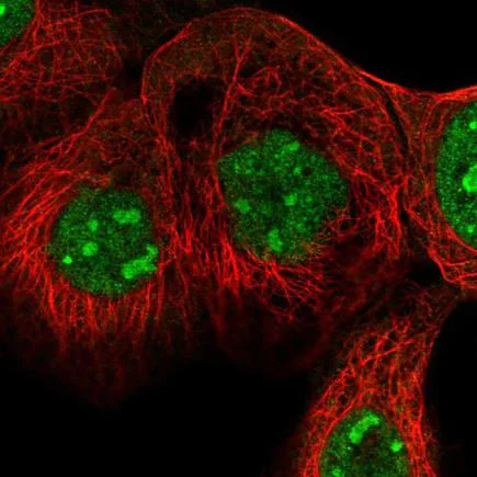 Immunocytochemistry/ Immunofluorescence - Anti-Sec8 antibody (AB220900)