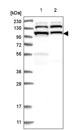 Western blot - Anti-Sec8 antibody (AB220900)