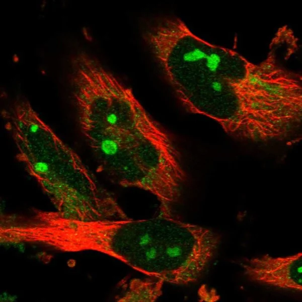 Immunocytochemistry/ Immunofluorescence - Anti-Sec8 antibody (AB224484)