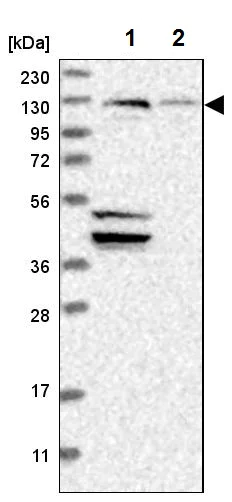 Western blot - Anti-Sec8 antibody (AB224484)