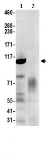 Immunoprecipitation - Anti-Sec8 antibody - C-terminal (AB205945)