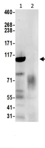 Immunoprecipitation - Anti-Sec8 antibody - C-terminal (AB205945)
