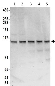 Western blot - Anti-Sec8 antibody - C-terminal (AB205945)