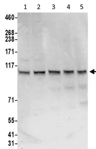Western blot - Anti-Sec8 antibody - C-terminal (AB205945)