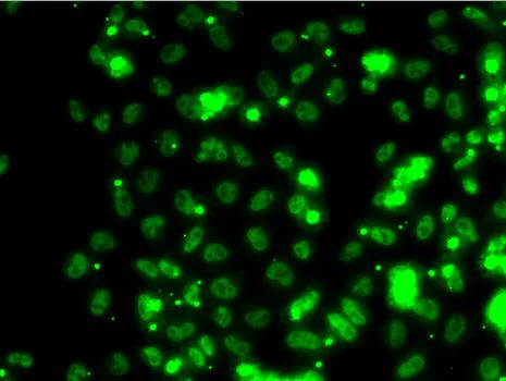 Immunocytochemistry/ Immunofluorescence - Anti-SECISBP2 antibody (AB210791)
