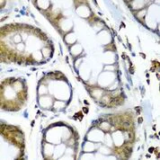 Immunohistochemistry (Formalin/PFA-fixed paraffin-embedded sections) - Anti-SECISBP2 antibody (AB210791)