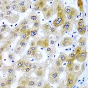 Immunohistochemistry (Formalin/PFA-fixed paraffin-embedded sections) - Anti-SECISBP2 antibody (AB210791)