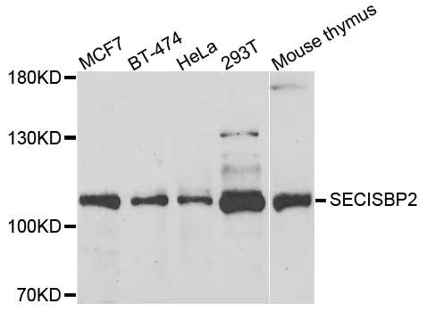 Western blot - Anti-SECISBP2 antibody (AB210791)