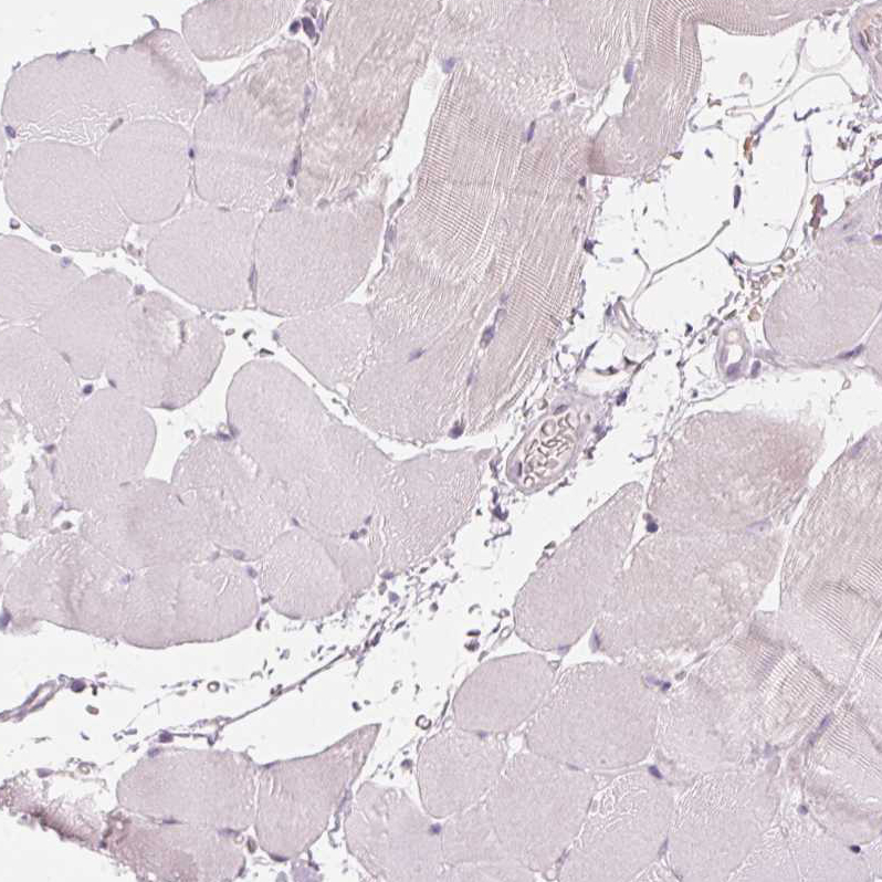 Immunohistochemistry (Formalin/PFA-fixed paraffin-embedded sections) - Anti-Secretin receptor/SCTR antibody (AB224236), expandable thumbnail