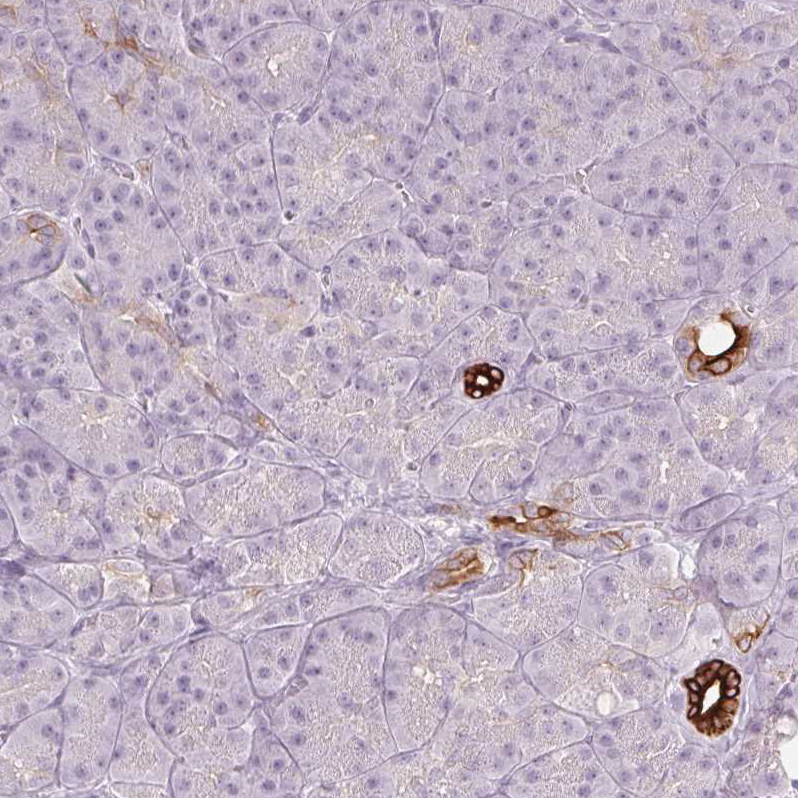 Immunohistochemistry (Formalin/PFA-fixed paraffin-embedded sections) - Anti-Secretin receptor/SCTR antibody (AB224236), expandable thumbnail