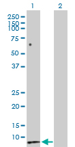 Western blot - Anti-Secretin/SCT antibody (AB103619), expandable thumbnail