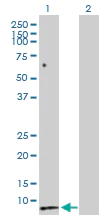 Western blot - Anti-Secretin/SCT antibody (AB103619)