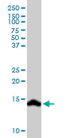 Western blot - Anti-Secretin/SCT antibody (AB103619), expandable thumbnail