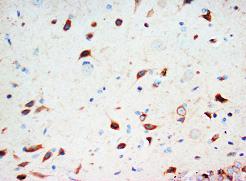 Immunohistochemistry (Formalin/PFA-fixed paraffin-embedded sections) - Anti-Secretogranin 3 antibody (AB65821)