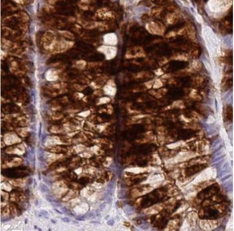 Immunohistochemistry (Formalin/PFA-fixed paraffin-embedded sections) - Anti-Secretory lectin ZG16 antibody (AB185483), expandable thumbnail
