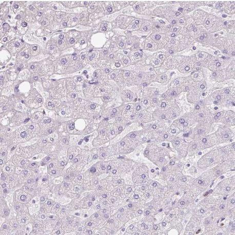 Immunohistochemistry (Formalin/PFA-fixed paraffin-embedded sections) - Anti-Secretory lectin ZG16 antibody (AB185483), expandable thumbnail
