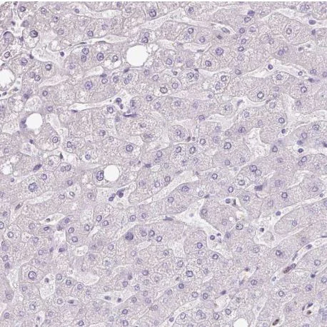 Immunohistochemistry (Formalin/PFA-fixed paraffin-embedded sections) - Anti-Secretory lectin ZG16 antibody (AB185483)