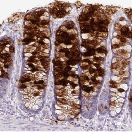 Immunohistochemistry (Formalin/PFA-fixed paraffin-embedded sections) - Anti-Secretory lectin ZG16 antibody (AB185483), expandable thumbnail