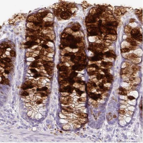 Immunohistochemistry (Formalin/PFA-fixed paraffin-embedded sections) - Anti-Secretory lectin ZG16 antibody (AB185483)