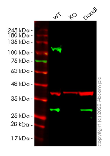 Western blot - Anti-Securin antibody [EPR3240] (AB79546), expandable thumbnail