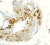 Immunohistochemistry (Formalin/PFA-fixed paraffin-embedded sections) - Anti-Securin antibody [EPR3240] - BSA and Azide free (ab239892), expandable thumbnail