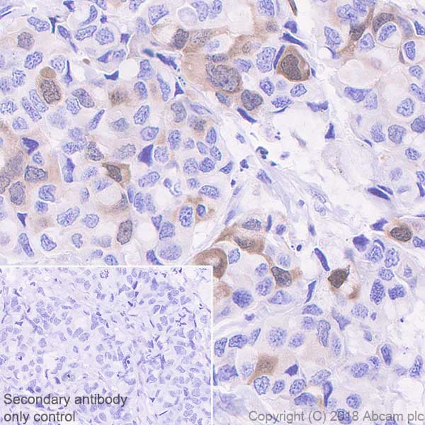 Immunohistochemistry (Formalin/PFA-fixed paraffin-embedded sections) - Anti-Securin antibody [EPR3240] - BSA and Azide free (AB239892), expandable thumbnail