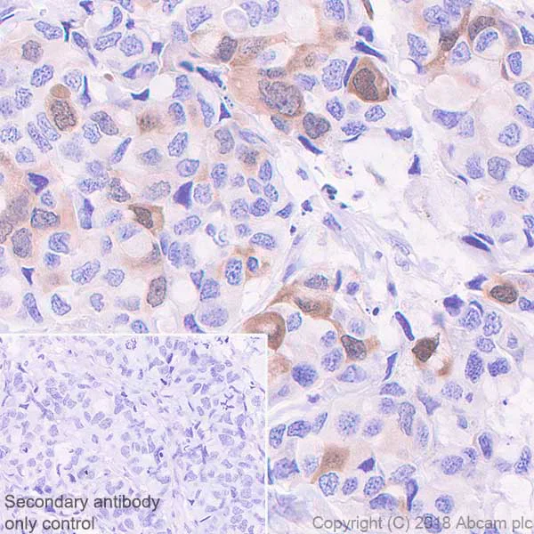 Immunohistochemistry (Formalin/PFA-fixed paraffin-embedded sections) - Anti-Securin antibody [EPR3240] - BSA and Azide free (AB239892)