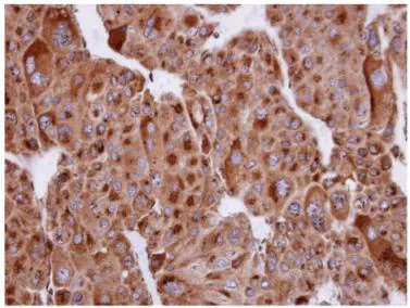Immunohistochemistry (Formalin/PFA-fixed paraffin-embedded sections) - Anti-SEI-1 antibody (AB154066)