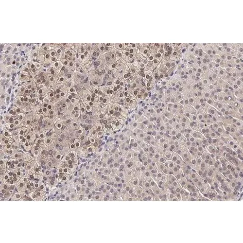 Immunohistochemistry (Formalin/PFA-fixed paraffin-embedded sections) - Anti-SEK1 / MKK4 antibody [HL1839] (AB317113)
