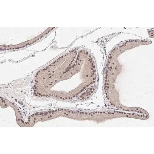 Immunohistochemistry (Formalin/PFA-fixed paraffin-embedded sections) - Anti-SEK1 / MKK4 antibody [HL1839] (AB317113)