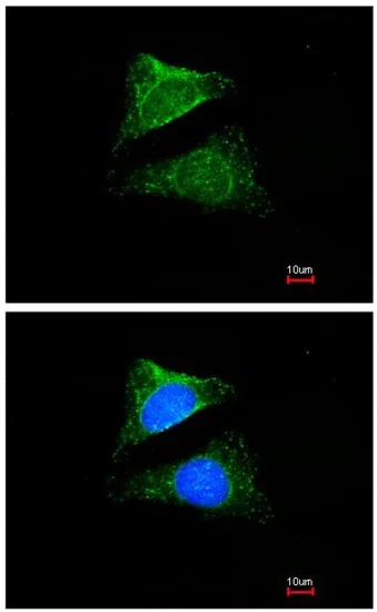 Immunocytochemistry/ Immunofluorescence - Anti-Seladin 1 antibody (AB137845)