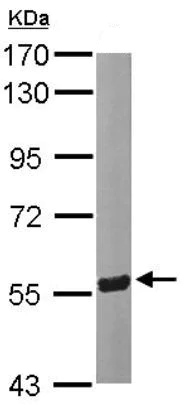 Western blot - Anti-Seladin 1 antibody (AB137845)