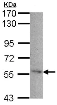 Western blot - Anti-Seladin 1 antibody (AB137845)